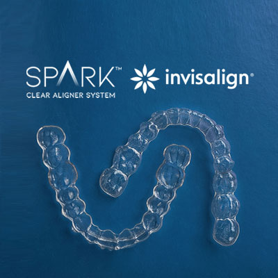 invisalign and spark aligners